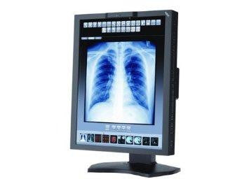 Nec Display Solutions 21in Color High-bright 3mp Led Backlit Lcd Medical Monitor With Front Sensor
